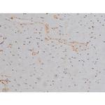 Phospho-Lyn (Tyr508) Antibody in Immunohistochemistry (Paraffin) (IHC (P))