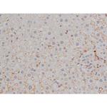 Phospho-Lyn (Tyr508) Antibody in Immunohistochemistry (Paraffin) (IHC (P))