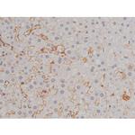 Phospho-Lyn (Tyr508) Antibody in Immunohistochemistry (Paraffin) (IHC (P))