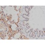 Phospho-Lyn (Tyr508) Antibody in Immunohistochemistry (Paraffin) (IHC (P))