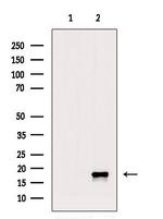 Phospho-Alpha-synuclein (Tyr136) Antibody in Western Blot (WB)