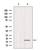 Phospho-Alpha-synuclein (Tyr136) Antibody in Western Blot (WB)