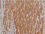 BMP-3 Antibody in Immunohistochemistry (Paraffin) (IHC (P))