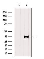 hnRNP C1/C2 Antibody in Western Blot (WB)
