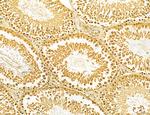 MKL1 Antibody in Immunohistochemistry (Paraffin) (IHC (P))