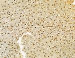 MKL1 Antibody in Immunohistochemistry (Paraffin) (IHC (P))