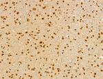 PIASy Antibody in Immunohistochemistry (Paraffin) (IHC (P))