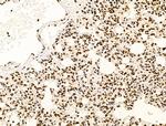 PIASy Antibody in Immunohistochemistry (Paraffin) (IHC (P))