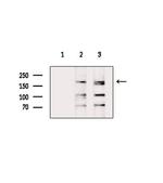 Fibronectin Antibody in Western Blot (WB)