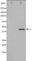 Dematin Antibody in Western Blot (WB)