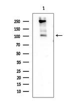 RB1 Antibody in Western Blot (WB)