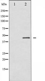 RPS6KB2 Antibody in Western Blot (WB)