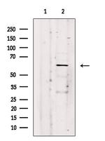 ARSK Antibody in Western Blot (WB)