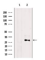 GRAP Antibody in Western Blot (WB)