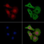 HOXD10 Antibody in Immunocytochemistry (ICC/IF)