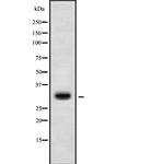 HOXD10 Antibody in Western Blot (WB)