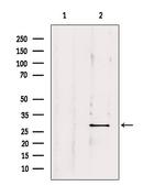 OTUB2 Antibody in Western Blot (WB)