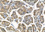 RPS2 Antibody in Immunohistochemistry (Paraffin) (IHC (P))