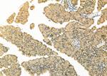 RPS2 Antibody in Immunohistochemistry (Paraffin) (IHC (P))