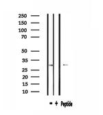 RPS2 Antibody in Western Blot (WB)