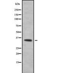 RTCA Antibody in Western Blot (WB)