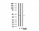 SS18 Antibody in Western Blot (WB)