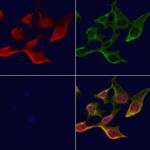 TXK Antibody in Immunocytochemistry (ICC/IF)