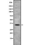 OR4A47 Antibody in Western Blot (WB)