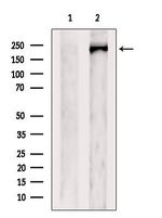 FIP200 Antibody in Western Blot (WB)