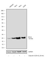 Phospho-MYL9 (Ser19) Antibody in Western Blot (WB)