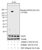 Phospho-EGFR (Tyr1125) Antibody in Western Blot (WB)