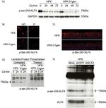 Phospho-KLF4 (Ser245) Antibody in Western Blot, Immunocytochemistry (WB, ICC/IF)