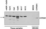 CYP2W1 Antibody in Western Blot (WB)