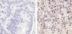 MEK1 Antibody in Immunohistochemistry (Paraffin) (IHC (P))