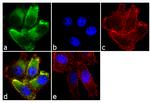 MMP13 Antibody in Immunocytochemistry (ICC/IF)