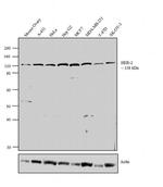 ErbB2 (HER-2) Antibody in Western Blot (WB)