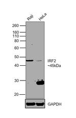 IRF2 Antibody in Western Blot (WB)