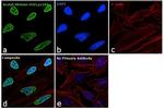 H3K18ac Antibody in Immunocytochemistry (ICC/IF)