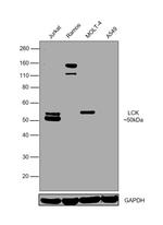 LCK Antibody in Western Blot (WB)