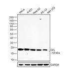 Cofilin Antibody in Western Blot (WB)