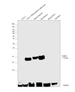 FABP4 Antibody in Western Blot (WB)