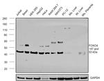 FOXO4 Antibody in Western Blot (WB)