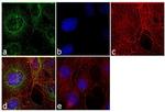 Tubulin alpha-1B Antibody in Immunocytochemistry (ICC/IF)