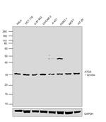 ATG5 Antibody in Western Blot (WB)