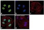 PARP1 Antibody in Immunocytochemistry (ICC/IF)