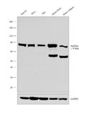 HADHA Antibody in Western Blot (WB)