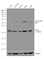 CDK4 Antibody in Western Blot (WB)