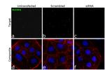 SGLT1 Antibody in Immunocytochemistry (ICC/IF)