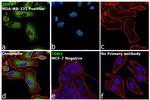 TGM2 Antibody in Immunocytochemistry (ICC/IF)