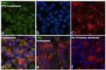 Fibronectin Antibody in Immunocytochemistry (ICC/IF)